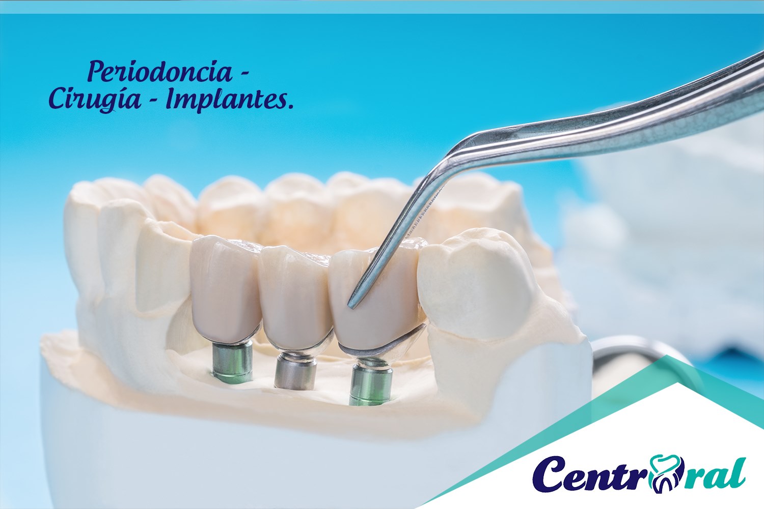 periodoncia